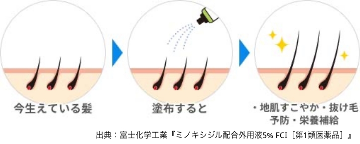 「成長期」「退行期」「休止期」